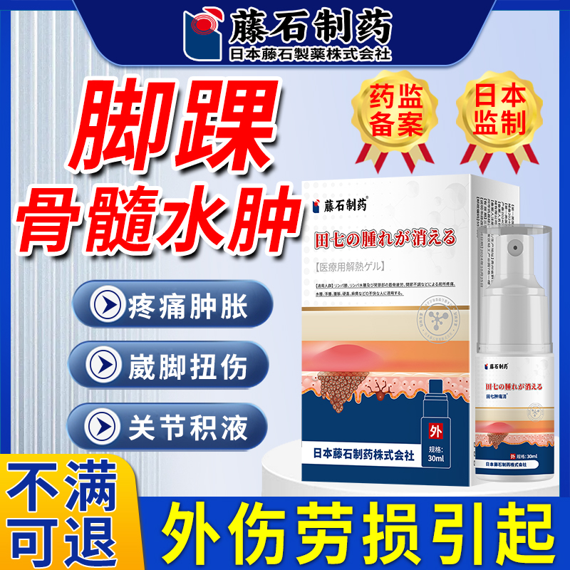 脚踝骨髓水肿韧带损伤滑膜炎关节积液除肿胀热敷可搭膏药贴YU