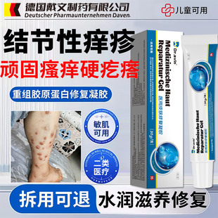 结节性痒疹特效治顽固红硬疙瘩皮肤湿疹专用真菌感染除疹止瘙痒ZY