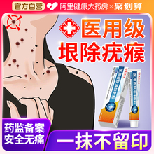 扁平疣软膏医用级祛疣瘊肉粒一抹无忧去疣膏斩草除根去除神器