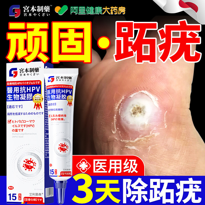 跖疣专用膏医用级除足底病毒疣连根拔去碘酊脚底趾疣老茧鸡眼贴
