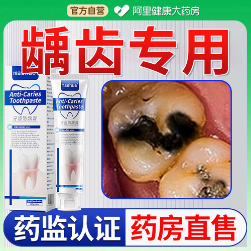 龋齿专用膏二类医疗器械