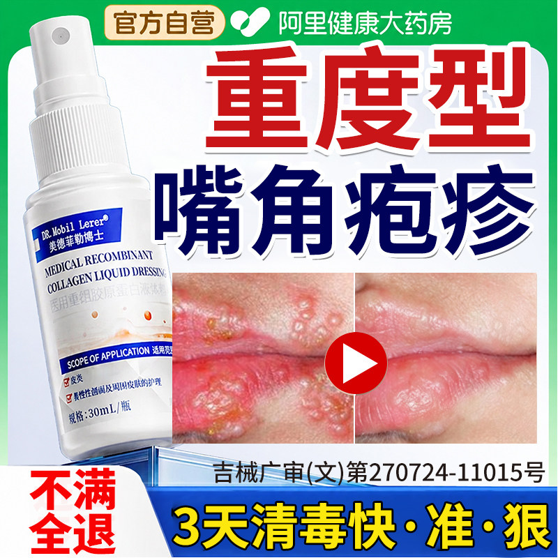 嘴角疱疹唇炎口角炎嘴唇干裂脱皮单纯用润唇膏烂嘴巴上火起泡效药