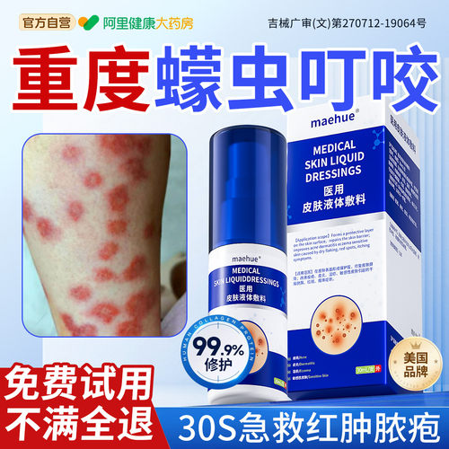 【胖东來热销】一喷急救蠓虫咬伤
