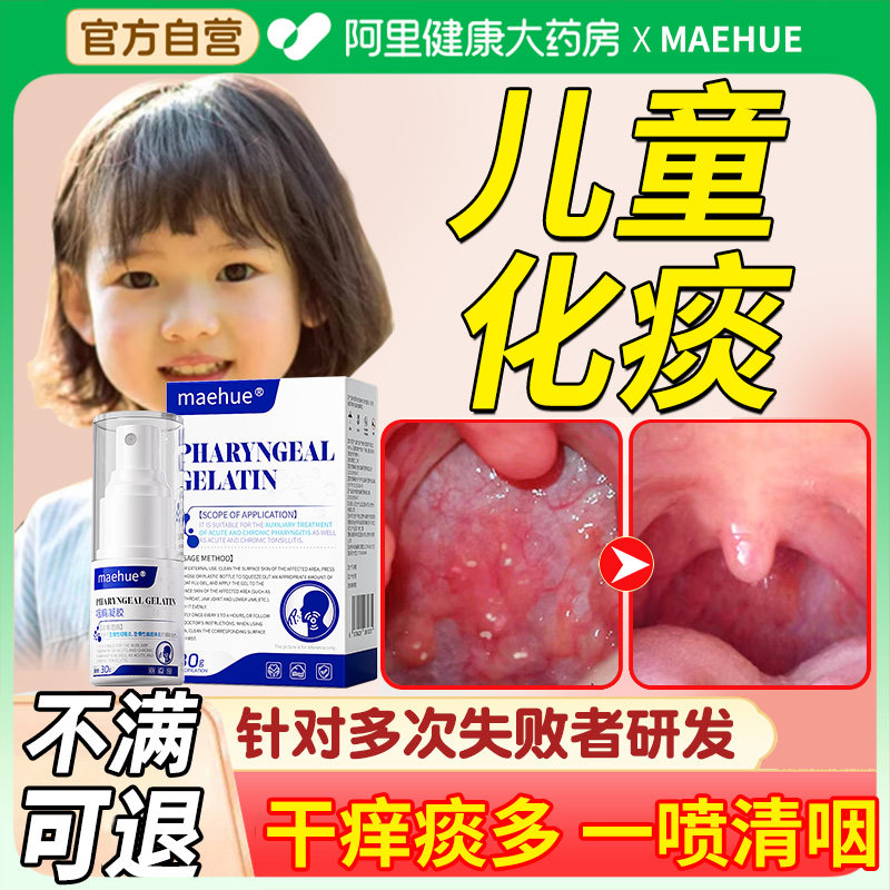 儿童频繁清嗓子咽喉炎慢性咽炎专用化痰止咳喉咙老有异物感咳嗽
