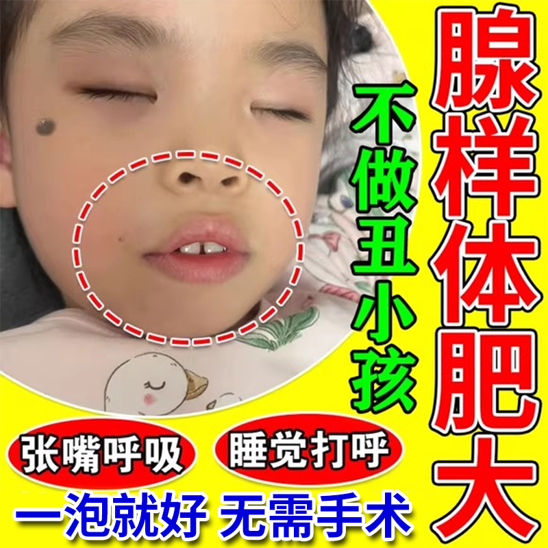 腺样体肥大泡脚药包苍耳子鼻窦炎中药过敏性鼻炎小儿童鼻舒艾叶草