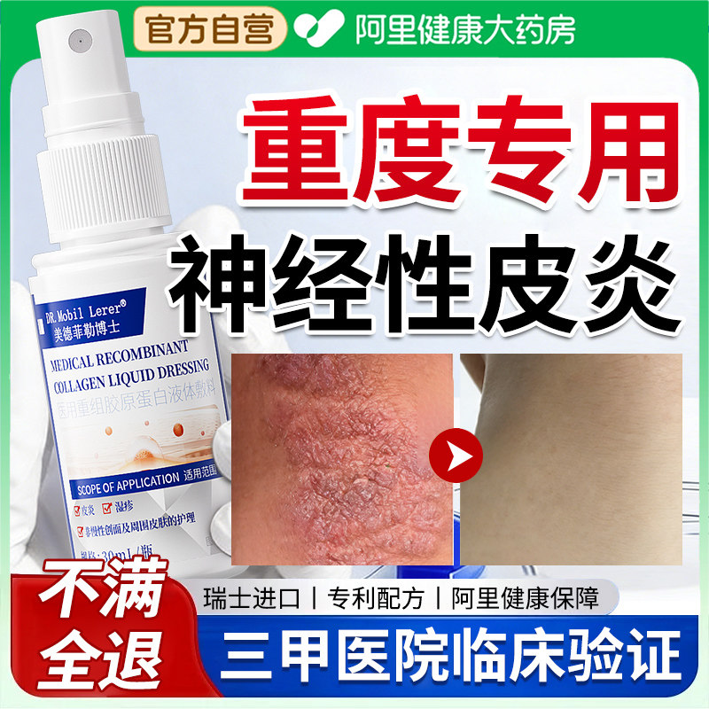 神经性皮炎专用外用膏皮肤病癣藓湿疹真菌感染治去祛除特进口疗
