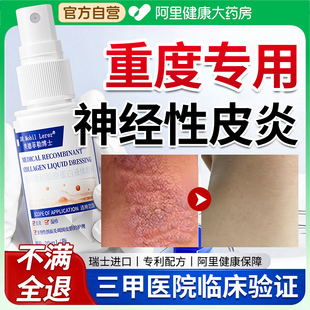 神经性皮炎专用外用膏皮肤病癣藓湿疹真菌感染治去祛除特效进口疗