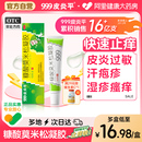 999皮炎平糠酸莫米松凝膠軟乳膏正品 神經(jīng)性皮炎濕疹汗皰疹止癢膏