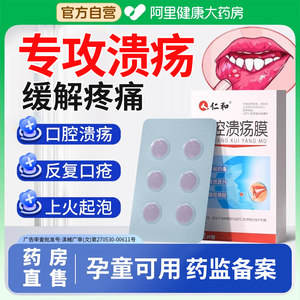 口腔溃疡贴膜上火起泡专用贴片