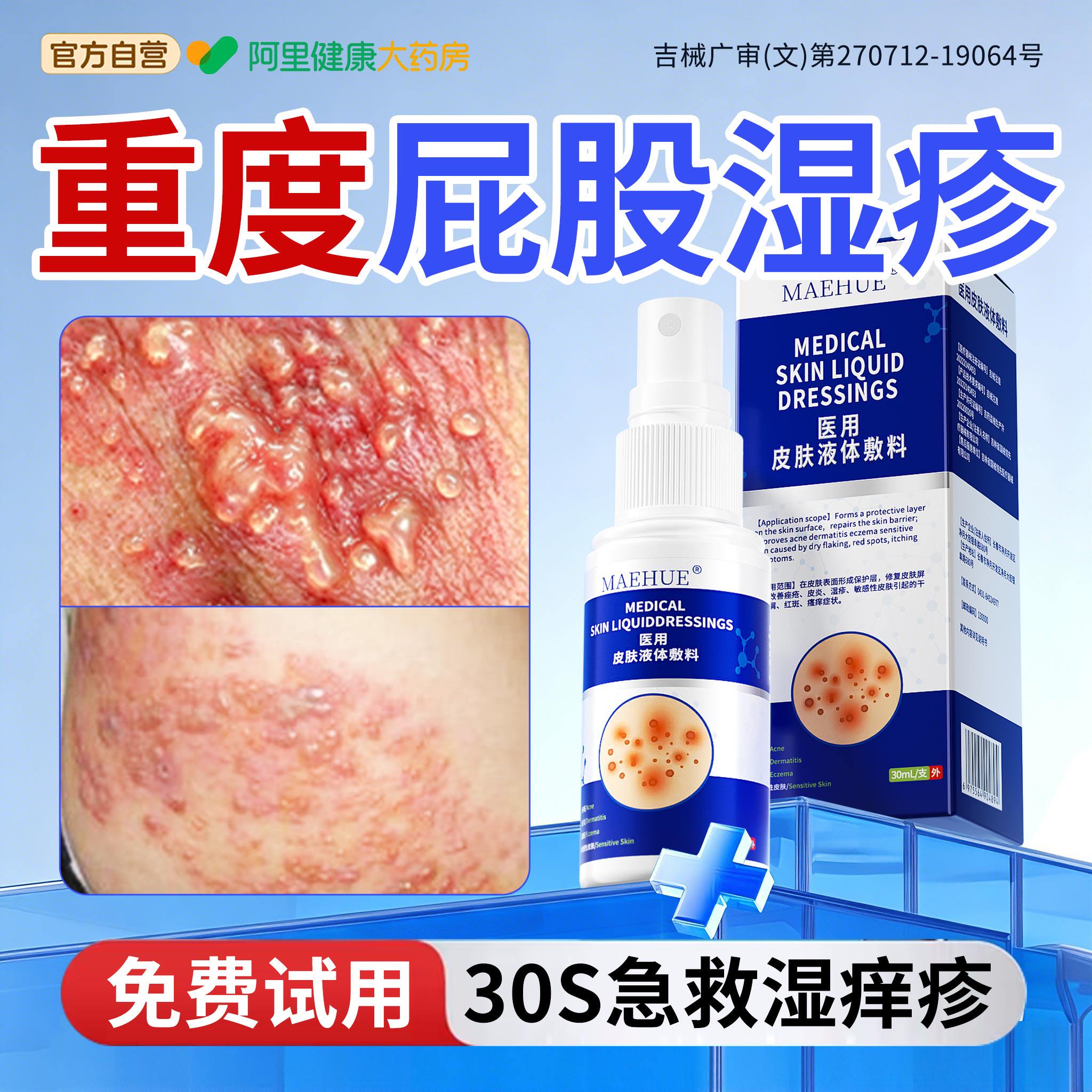 【药监局备案】美国急救屁股湿疹图片