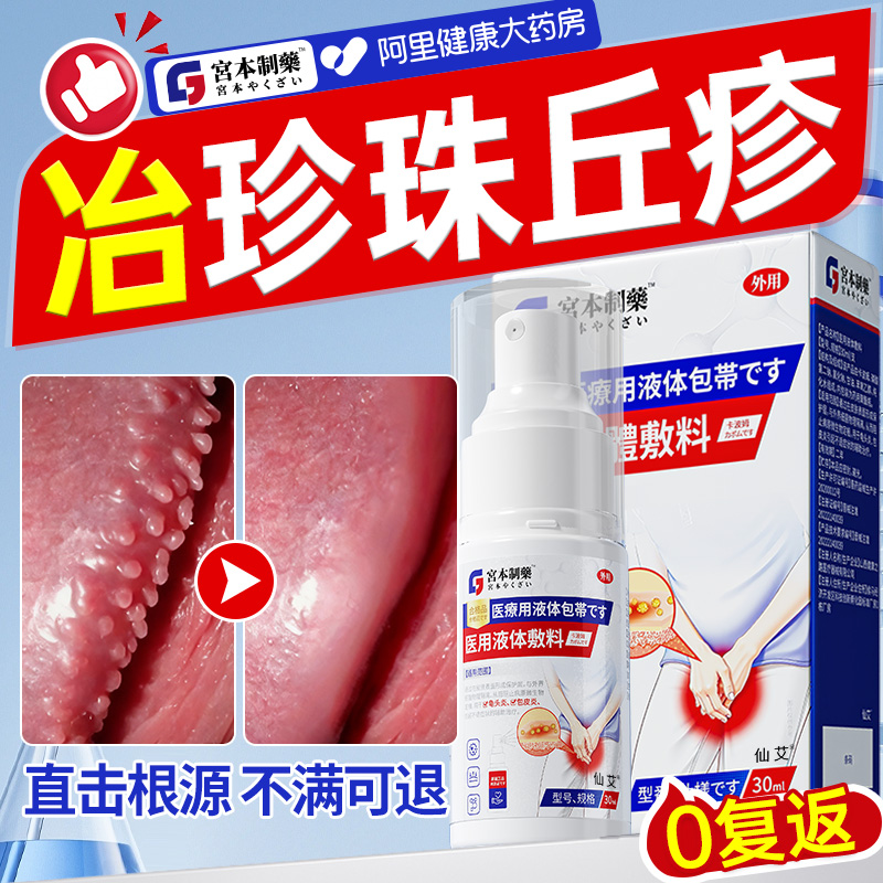 男性龟头小肉芽珍珠疹去除