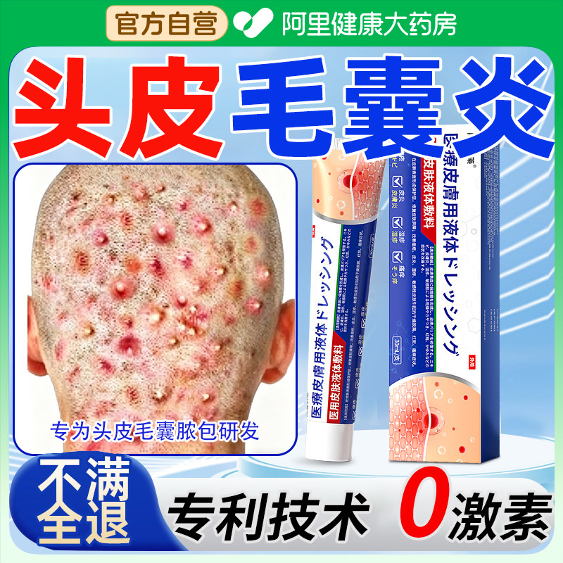 头皮毛囊炎头部专用除螨头皮清洁控油去屑止痒头上长疙瘩痘痘去螨
