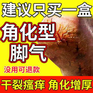 角化型脚气脚后跟开裂专用真菌感染足跟鳞屑起硬皮非药