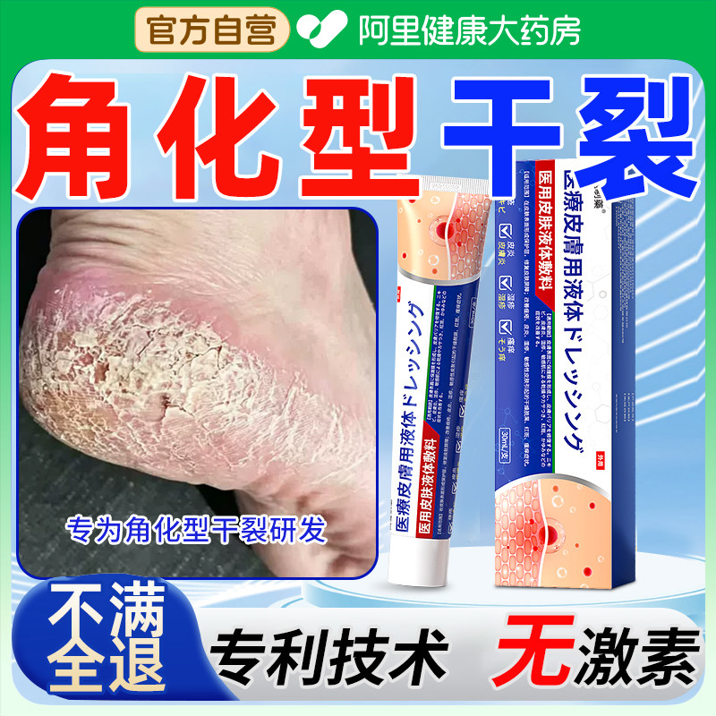 角化型干裂真菌感染脚后跟起硬皮去脚气鹅掌风湿疹脱皮足癣止痒膏