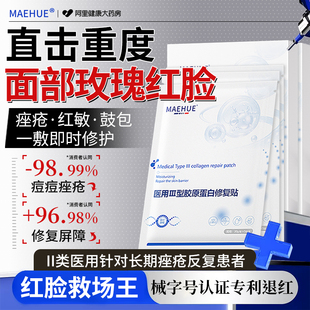 医用冷敷贴型玫瑰痤疮屏障效抗受损修复用酒糟鼻炎专特药