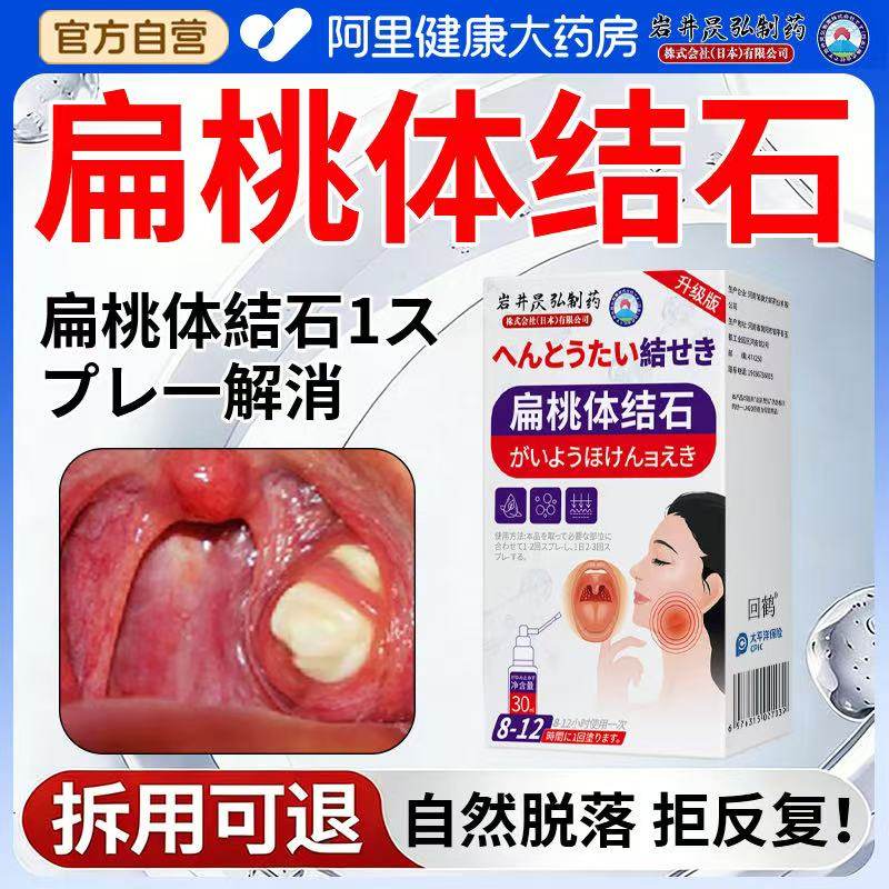 扁桃体结石去除工具冲洗器口臭隐窝清理口腔神器漱口水非电动喷剂