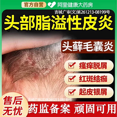 【阿里药房直售】头部脂溢性皮炎
