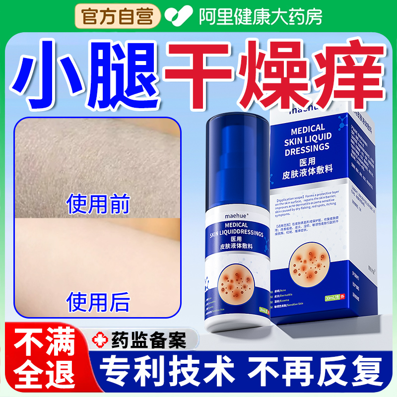【效果NO.I】小腿干燥瘙痒不反复