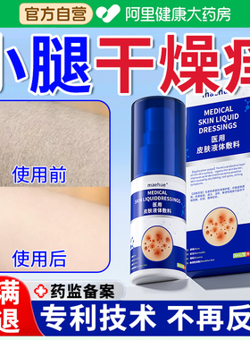 冬天皮肤干燥腿痒小腿瘙痒起皮痒掉皮屑膏冬季腿部鱼鳞纹抑菌止痒