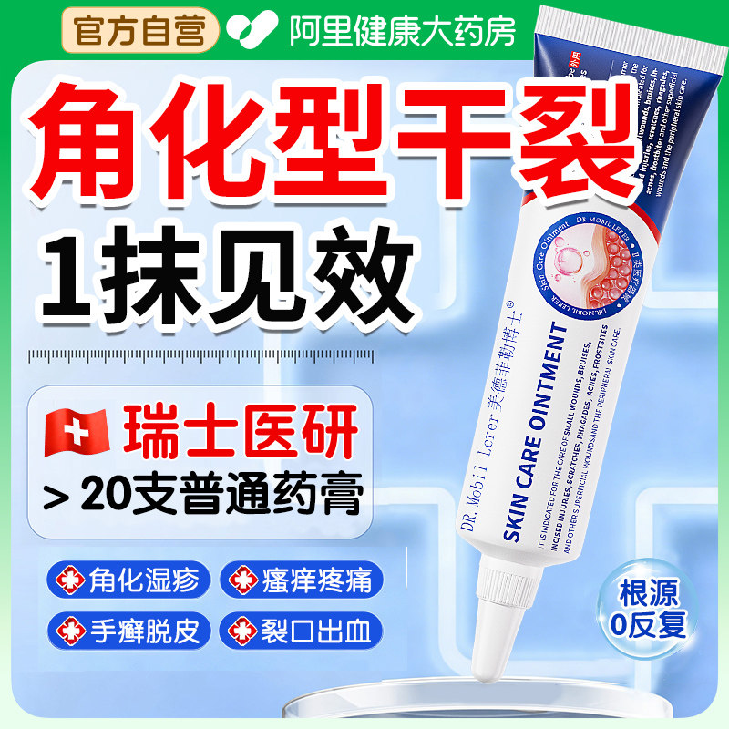 角化型手部手癣干裂药膏手指湿疹脱皮真菌感染手足皲裂裂口出血