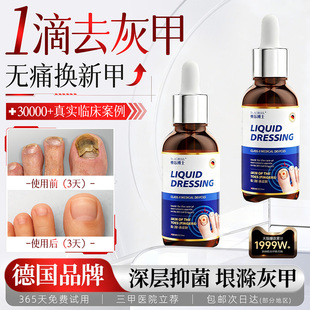 德国灰指甲阿莫罗芬专用抑菌液冰醋酸涂剂搽剂灰指甲正品 旗舰店