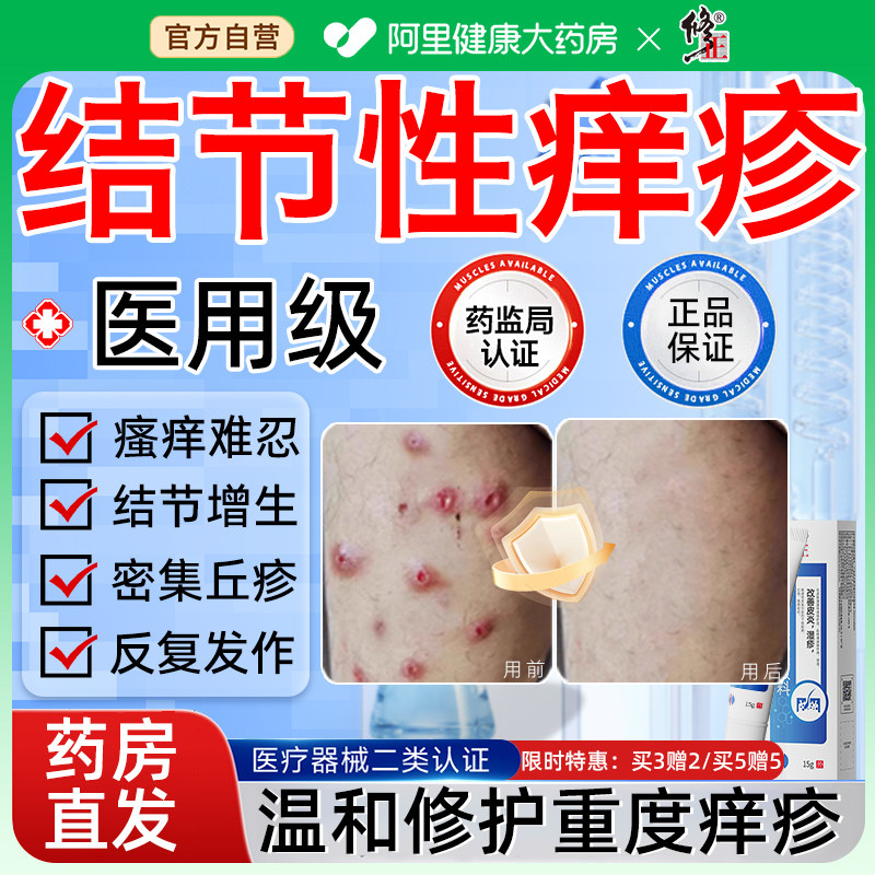 特治顽固硬疙瘩皮肤湿疹皮炎红肿止痒真菌感染膏效专用结节性痒疹