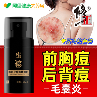 前胸后背长痘痘毛囊炎马拉色菌毛囊炎背上长痘痘毛囊炎除螨祛痘痒