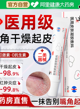 嘴角干燥起皮有碎屑口周皮炎面部脂溢性嘴巴周围过敏泛红脱皮瘙痒