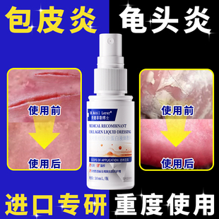 包皮炎龟头炎症男士男性专用私处开裂真菌抑菌豆腐渣白垢喷剂湿疹