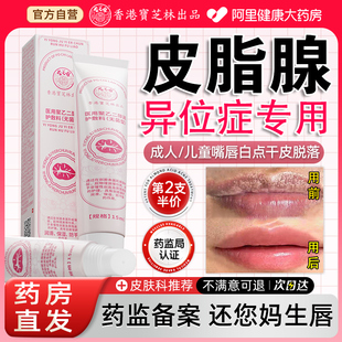 皮脂腺异位症嘴唇白点脂肪小颗粒药膏脂肪粒去神器除面部丘疹增生