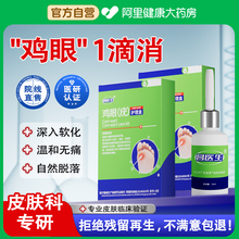 鸡眼贴膏药水脚钉祛除膏鸡茧眼液肉刺老茧跖疣瘊专用正品旗舰店