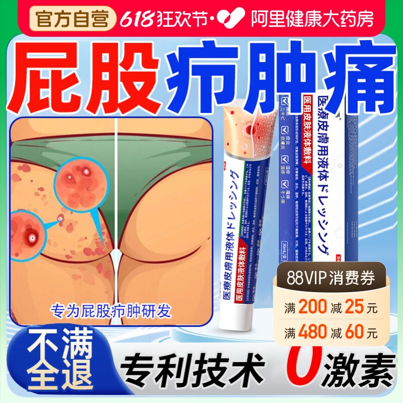 屁股上长火疖子屁股上长痘痘痒起热疙瘩久坐板疮硬疙瘩脓包硬块膏