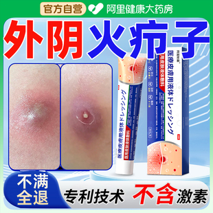 外阴疖肿拔毒膏火疖子药膏拔脓膏脓包硬块敷贴屁股上私处长痘痘