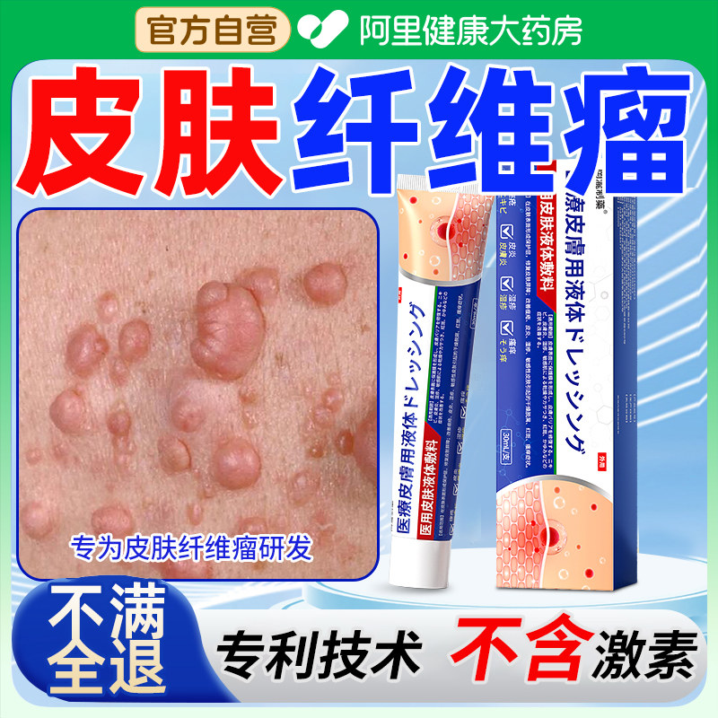 皮肤纤维瘤药膏神器消瘤疙瘩结节小腿皮下鼓包肿硬块囊肿肉粒除膏