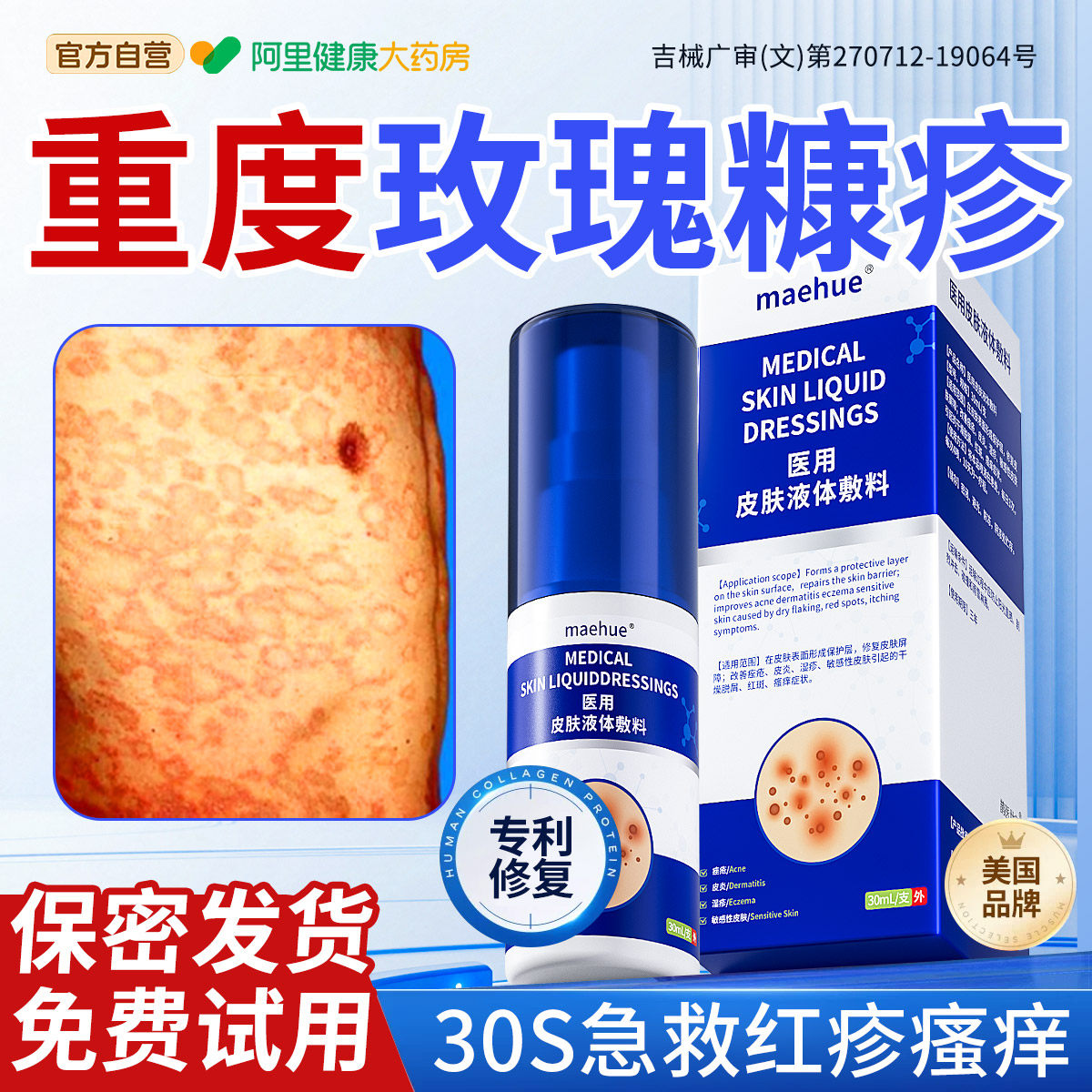 玫瑰糠疹软膏儿童脸上长白斑湿疹皮炎感染瘙痒止痒红斑专用除糠疹