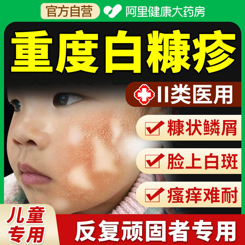 白色糠疹药膏儿童脸上长白斑癣小孩汗斑皮肤瘙玫瑰桃花瘙痒湿疹