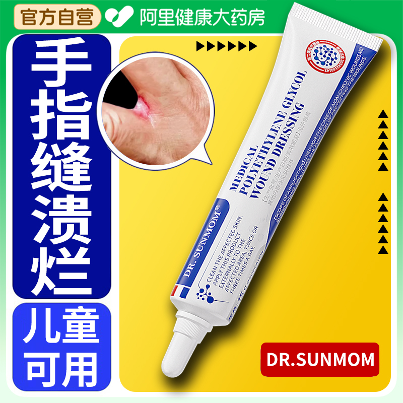 手指缝溃烂药膏烂痒水泡止痒手藓糜烂开裂湿疹角化型烂手丫用专药