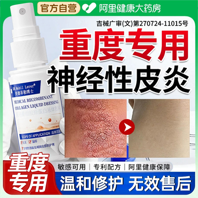 神经性皮炎专外用膏皮肤病癣藓湿疹真菌感染治去祛特进口除疗用