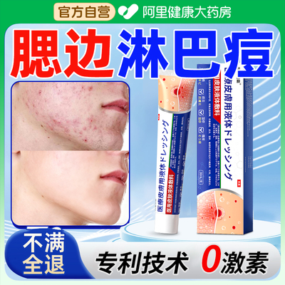 淋巴痘腮边痘下巴脖子反复长痘痘硬块痤疮上脸颊两边结节玫瑰痤疮