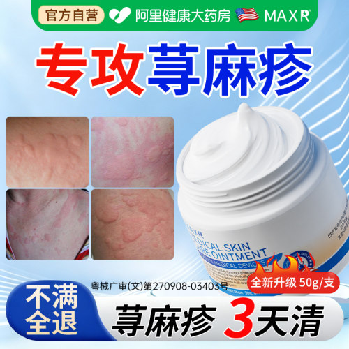 寻荨麻疹治过敏特止跟风团性急慢性提高断痒效免疫力抑菌膏专用膏