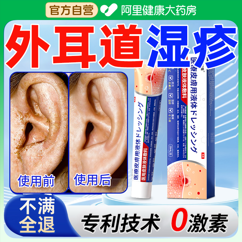 耳道真菌感染发炎药膏湿疹耳道抑菌痒用什么