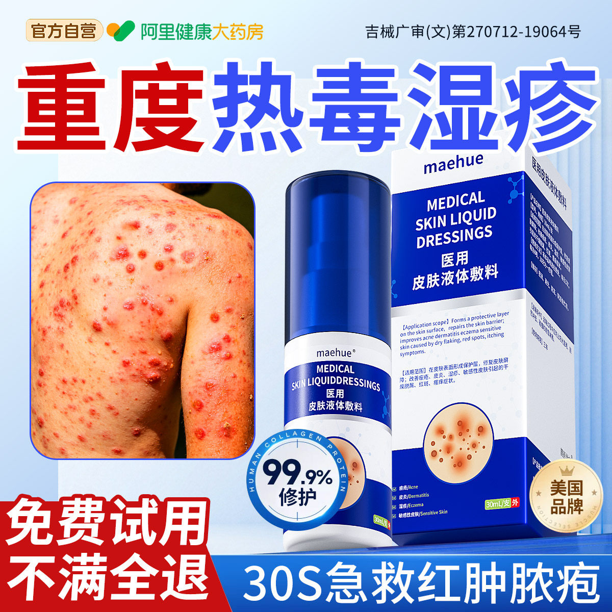 热毒湿疹止痒膏医外用苗顽固皮炎皮肤一热就痒特药清湿毒痒根方喷