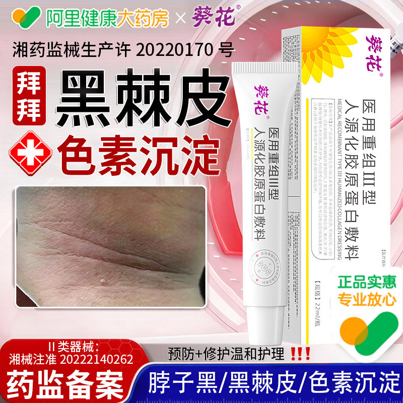 脖子黑色素去除脖颈黑色素沉淀黑棘皮药膏肥胖症黑洗不干净儿童