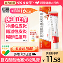 皮炎濕疹止癢膏老款 999皮炎平三九復(fù)方醋酸地塞米松乳膏軟膏正品