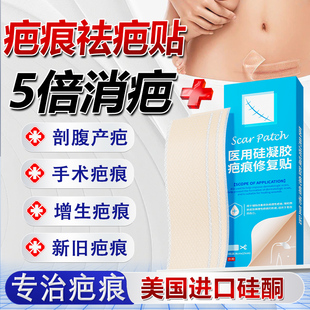 美国进口硅酮疤痕贴剖腹产刨宫甲状腺术后减张贴医用美皮肤祛疤贴