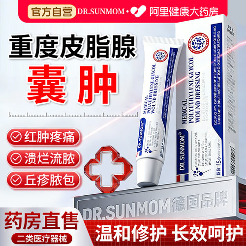 【皮脂腺囊肿膏】【德国品牌】