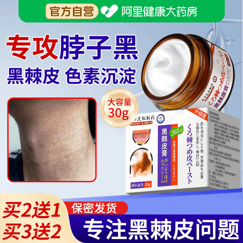 脖子黑黑棘皮症去除脖子黑色素沉淀去黑病药膏肥胖脖颈洗不干净