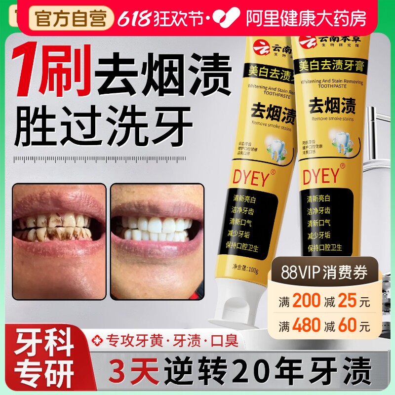 牙齿清洁美白去黄去口臭去烟渍牙结石速美白齿膏效官方旗舰店正品