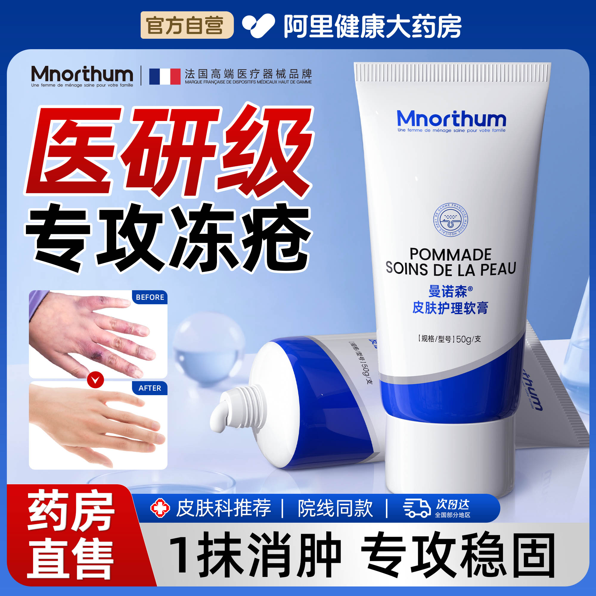 冻疮膏止痒冻伤膏医用特效防冻裂儿童耳朵护手足霜正品官方旗舰店