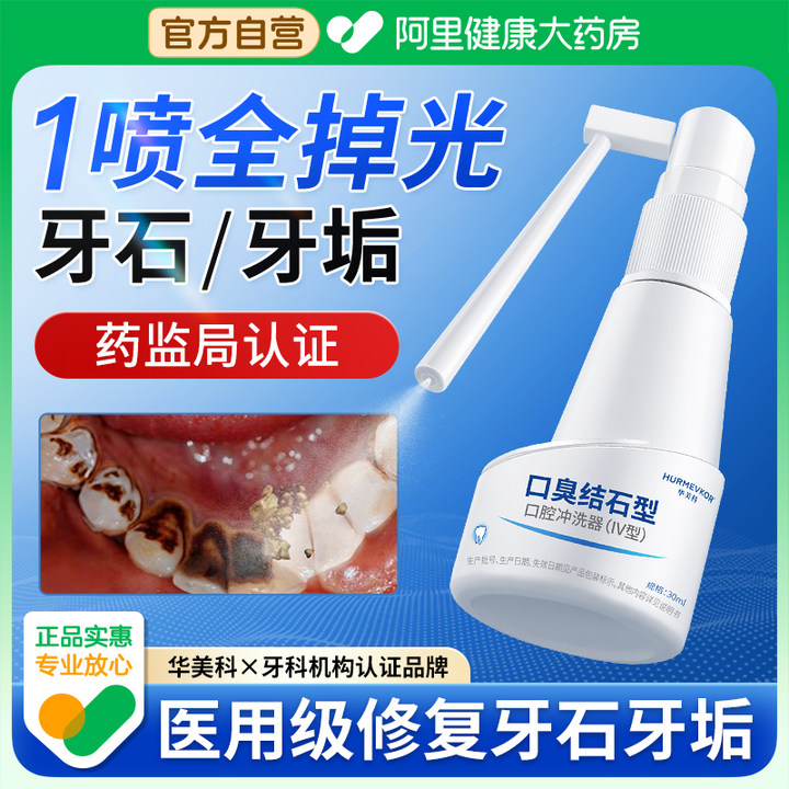 【口腔医师推荐】一喷牙石掉光